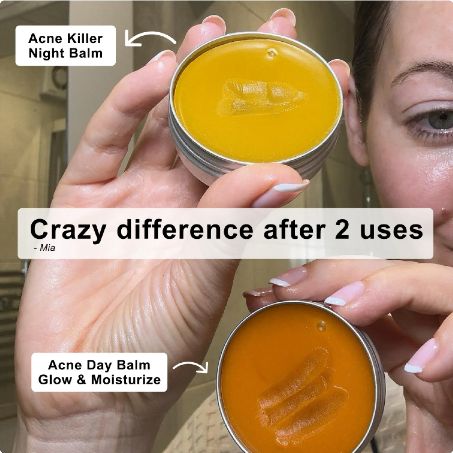 Norse Organics Redness & Breakout Support Ritual